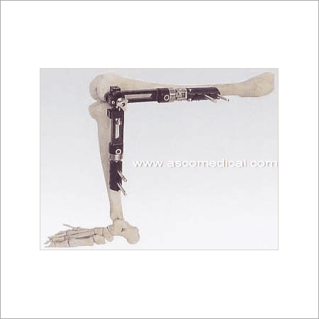 Knee Joint External Fixator