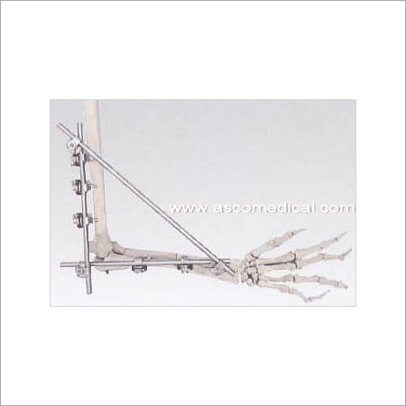 Elbow External Fixator