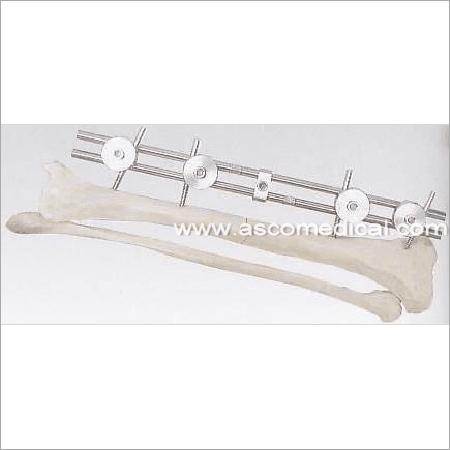 Unilateral External Fixator - Stainless Steel, 8-12mm Diameter, 6-8 Pins | Fracture Stabilization, Bone Alignment, Adjustable Length