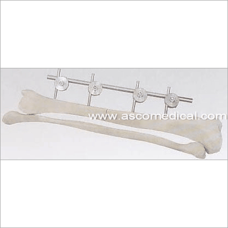 Unilateral External Fixator - Stainless Steel, 4-6mm Pins, Variable Length | Fracture Stabilization, Adjustable, Lightweight Design