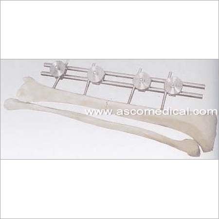 Unilateral External Fixator