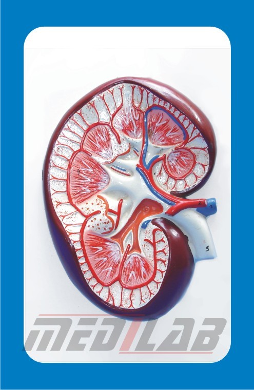 HUMAN KIDNEY SECTION, on wooden/plastic base