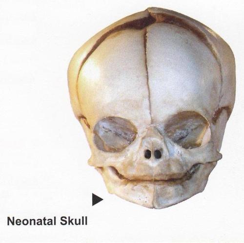 NEONATAL SKULL
