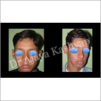 Non Surgical treatments