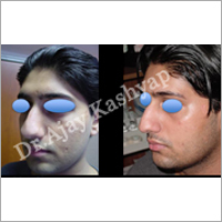 Specialized Treatments for Teens
