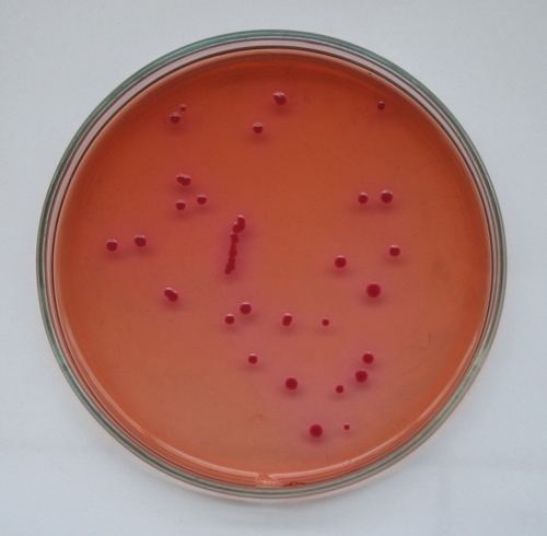 EMB AGAR EMB AGAR
