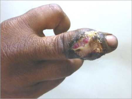 Medical Services For Blast Injury - Hospital Facility, Advanced Surgical Tools | Trauma Care, Rapid Response, Wound Treatment, Infection Control, Surgical Repair