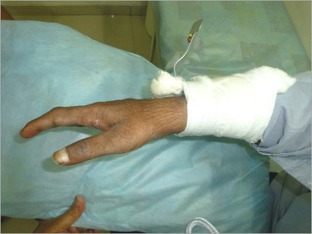 Medical Treament For Surgical Injury