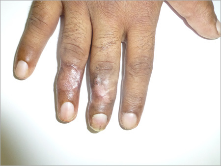 Medical Treatment For Surgical Injury