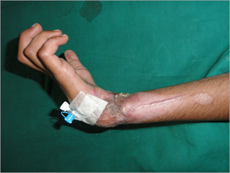 Medical Treament For Surgical Injury