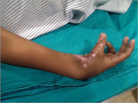 Medical Services For Surgical Injury
