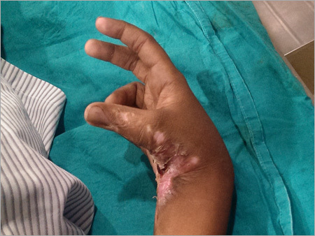 Medical Services For Surgical Injury