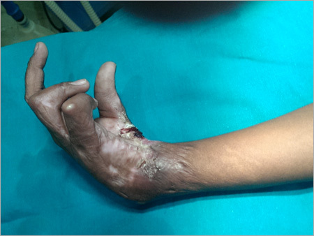 Medical Treament For Surgical Injury