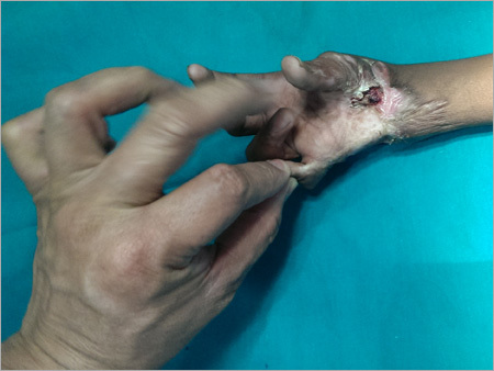 Medical Services For Blast Injury