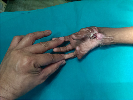 Medical Solution For Surgical Injury