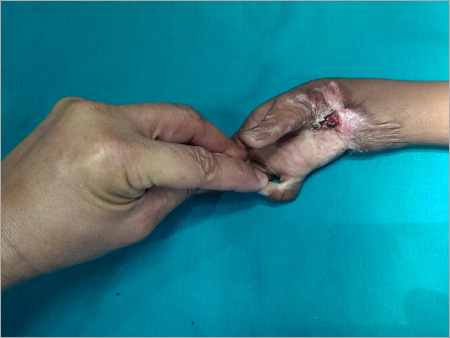 Medical Services For Blast Injury