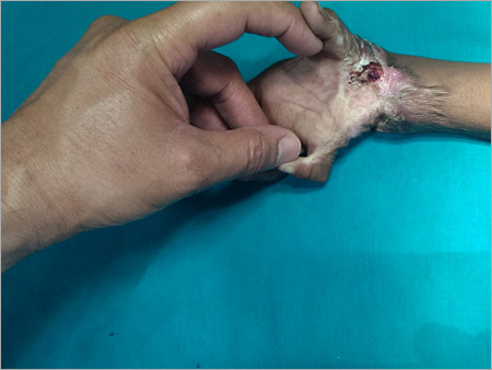 Medical Services For Surgical Injury