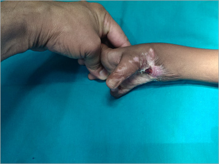 Medical Treament For Surgical Injury