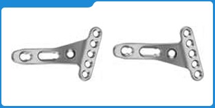 Distal Radius Locking Plate