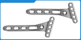 Distal Radius Locking Plate