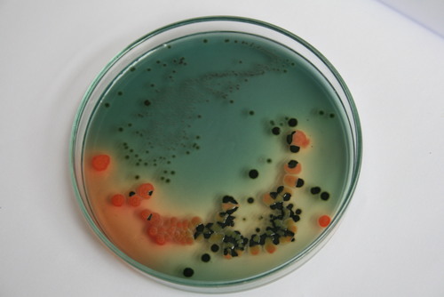 HEKTOEN ENTERIC AGAR