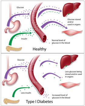 Hormonal Depression Treatment