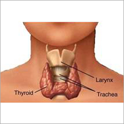 Natural Thyroid Healing