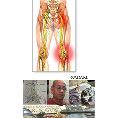 Sciatica Treatment