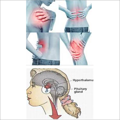Joint Pains Treatment