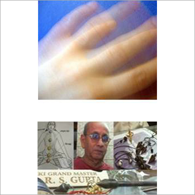 Essential Tremor Treatment