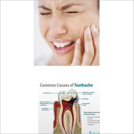 Toothache Treatment