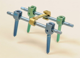 Pedicular Screw