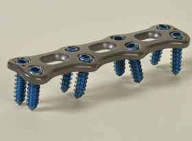 Anterior Cervical Plating System
