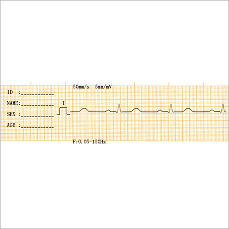 Hospital ECG Machine