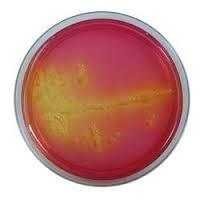 Bromocresol Purple