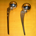Austin Moore Prosthesis