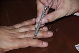 ACi Needle Inserter - Six Key Spring