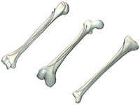 Titanium Elastic Nail