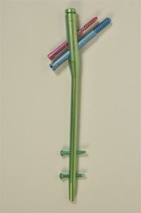 Proximal Femoral Nail