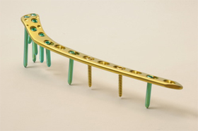 Locking Proximal Lateral Tibia Plate