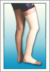 Varicose veins