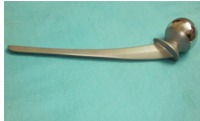 HIP PROSTHESIS