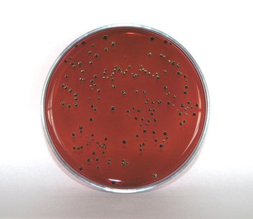 Eosin Methylene Blue Agar