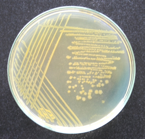 Cysteine lactose electrolyte deficient agar