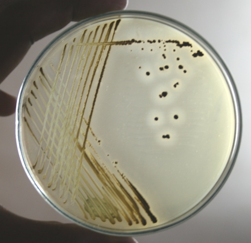 Baird Parker Agar Base