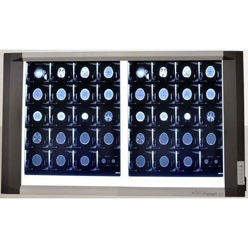 Led X-Ray View Box With Double Film - Darkness Range: >10000K