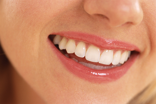 Smile Improvement Dental Surgery