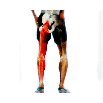 Sciatica Acupressure Treatment