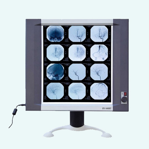 LED X-ray View Box
