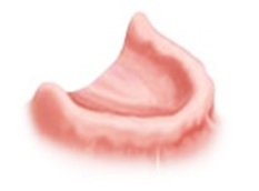 Dental Implants For All Missing Teeth